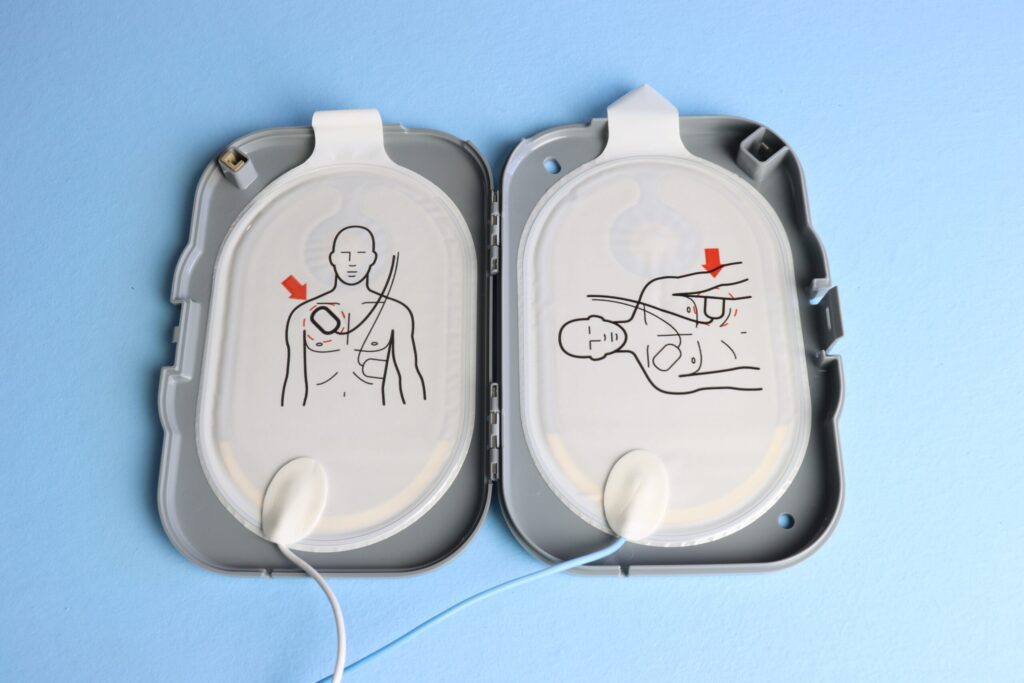 Illustration showing proper placement of AED pads on the chest to administer an effective defibrillation, guiding users to ensure correct electrode positioning during an emergency.