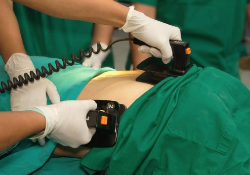 Understanding AED Power: Do Defibrillators Have Batteries? 